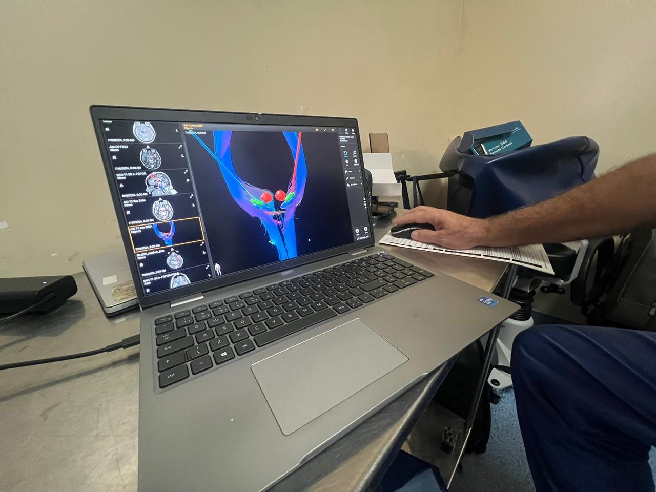 cirurgia-parkinson-2